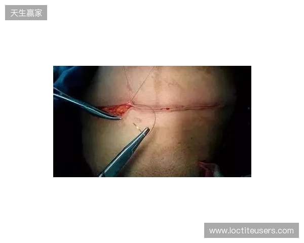 广州豹官方:杨浩眉弓伤口缝合30余针,预计5-7天后拆线 广州豹官方:杨浩眉弓伤口缝合30余针,预计5-7天后拆线